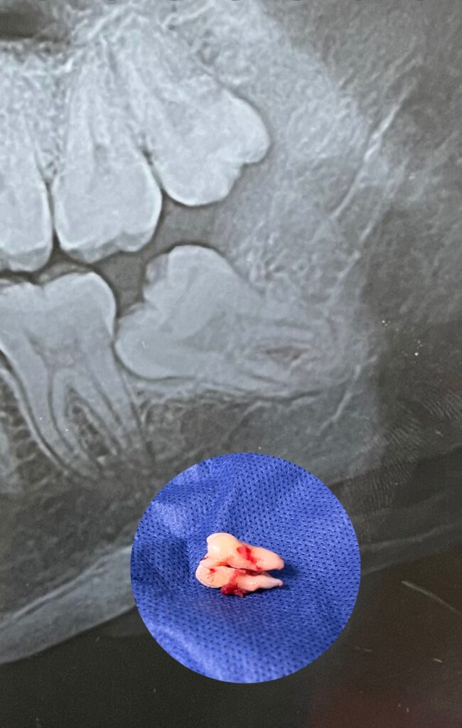 19606 cirujano dentista alba lopez cortez 650x1024