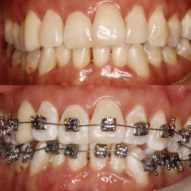 19625 dentalpro sjr 768x768