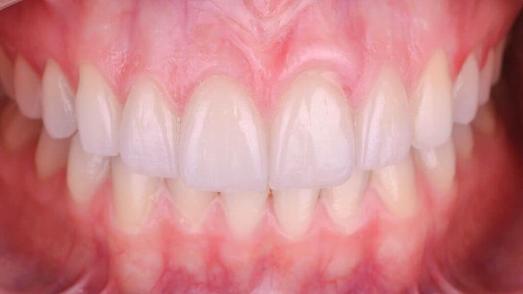 19737 dentista gustavo gaytan salim 1024x576