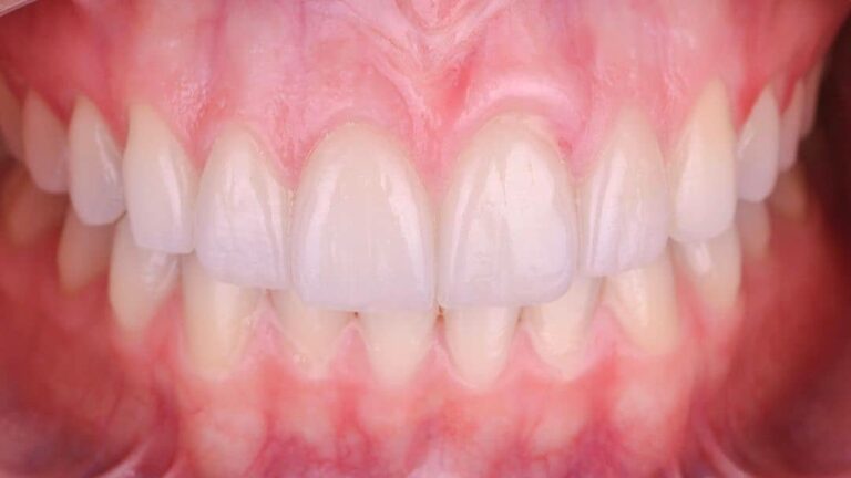 19737 dentista gustavo gaytan salim 768x432