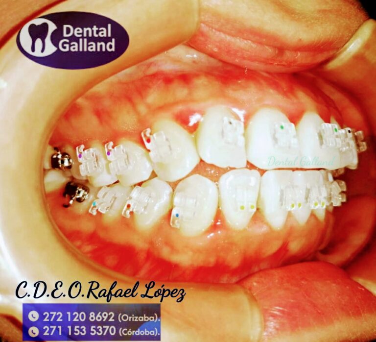 19742 dental galland orizaba 768x698